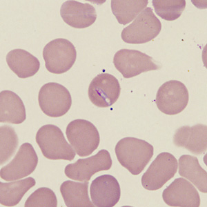 Case431_B.jpg