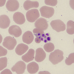 Case431_F.jpg