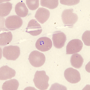 Case431_H.jpg