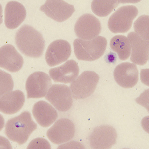 Case431_J.jpg