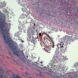 Case432_A.jpg