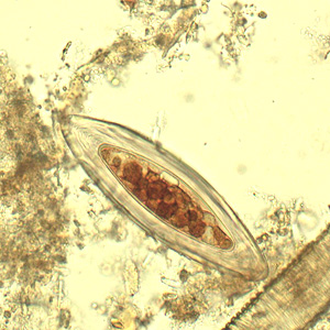 Case433_C.jpg