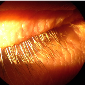 Case435_A.jpg