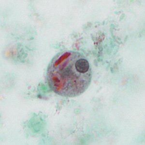 case440_D2