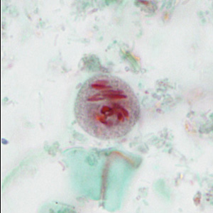 case440_E2