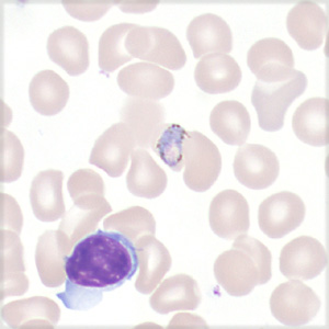 Case443_B Case 443