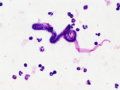 Case446_A Case446