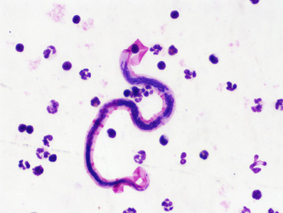 Case446_B Case446