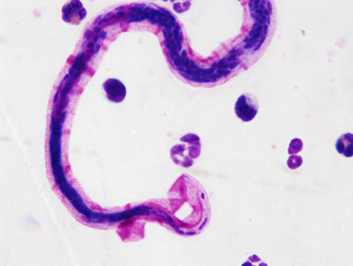 Case446_D Case446