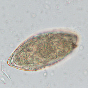 AUGUST - 2017 - Case #449 parasitic image