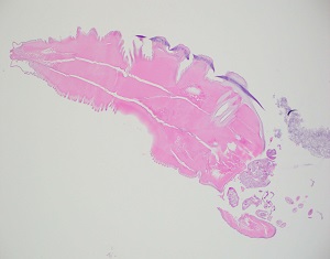 December - 2017 - Case #458 parasitic image