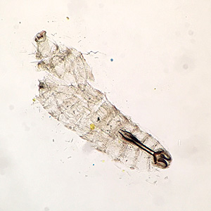 JANUARY - 2018 - Case #459 parasitic image
