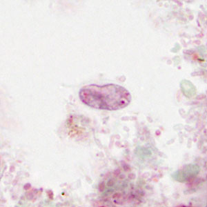 SEPTEMBER - 2018 - CASE #475 parasitic image
