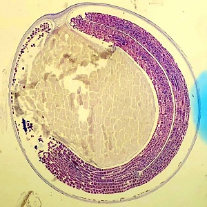 OCTOBER - 2018 - CASE #477 parasitic image