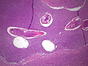 NOVEMBER - 2018 - CASE #479 parasitic image