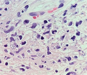 DECEMBER - 2018 - CASE #481 parasitic image