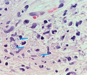 Case480_A Answer parasitic image