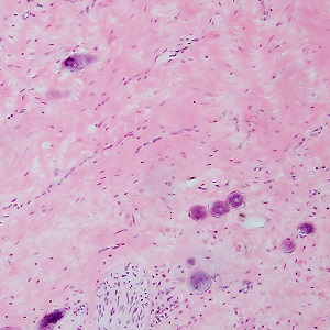 parasitic image