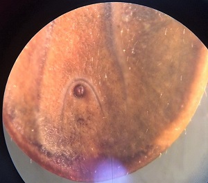 Case490_E Figure E