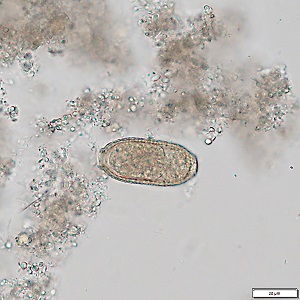MAY - 2019 - CASE #492 parasitic image