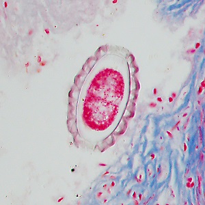 Case495_K Figure K