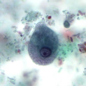 Case497_B Figure B