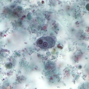Case497_C Figure C