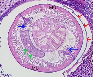 Case498_B_Answer