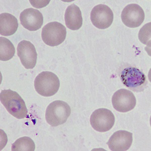 Case499_E Figure E