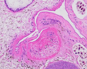 Case501_B Figure B