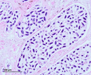 Case501_C Figure C