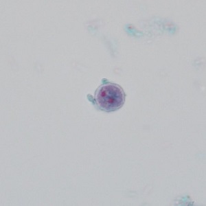 Case_503_E Figure E