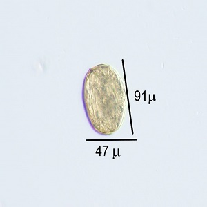 NOVEMBER - 2019 - CASE #504 parasitic image
