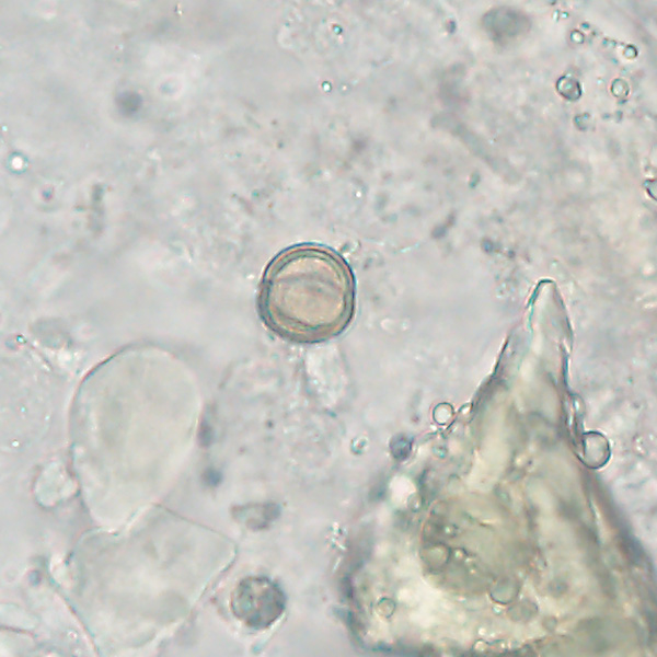 Case527_B Figure B