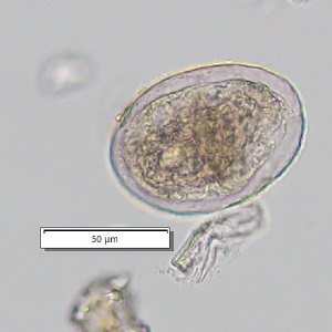 Case_510_D Figure D