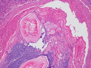 Case_511_B Figure B