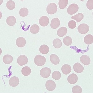 APRIL - 2020 - CASE #514 parasitic image