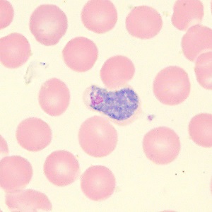 Case_515_B Figure B