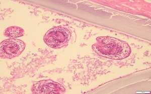 Case_516_B Figure B