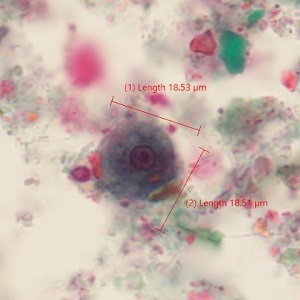 Case_520_B Figure B