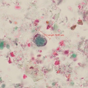Case_520_D Figure D