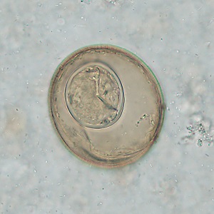 Case_519_B Figure B