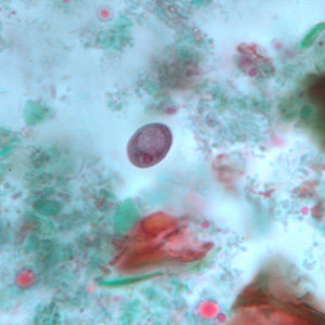 Figure B