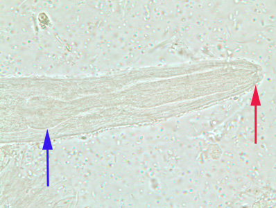 Figure C
