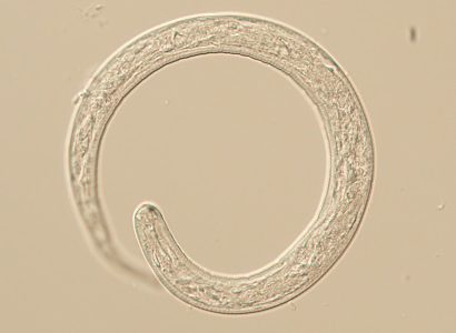 Figure A: L1 larva of Thelazia sp., likely T. callipaeda based on the patient&rsquo;s travel history. L1 larvae measure up to 400 &micro;m long and 13.5 &micro;m wide. While not visible on this specimen, normally larvae are passed encased in a shell membrane.