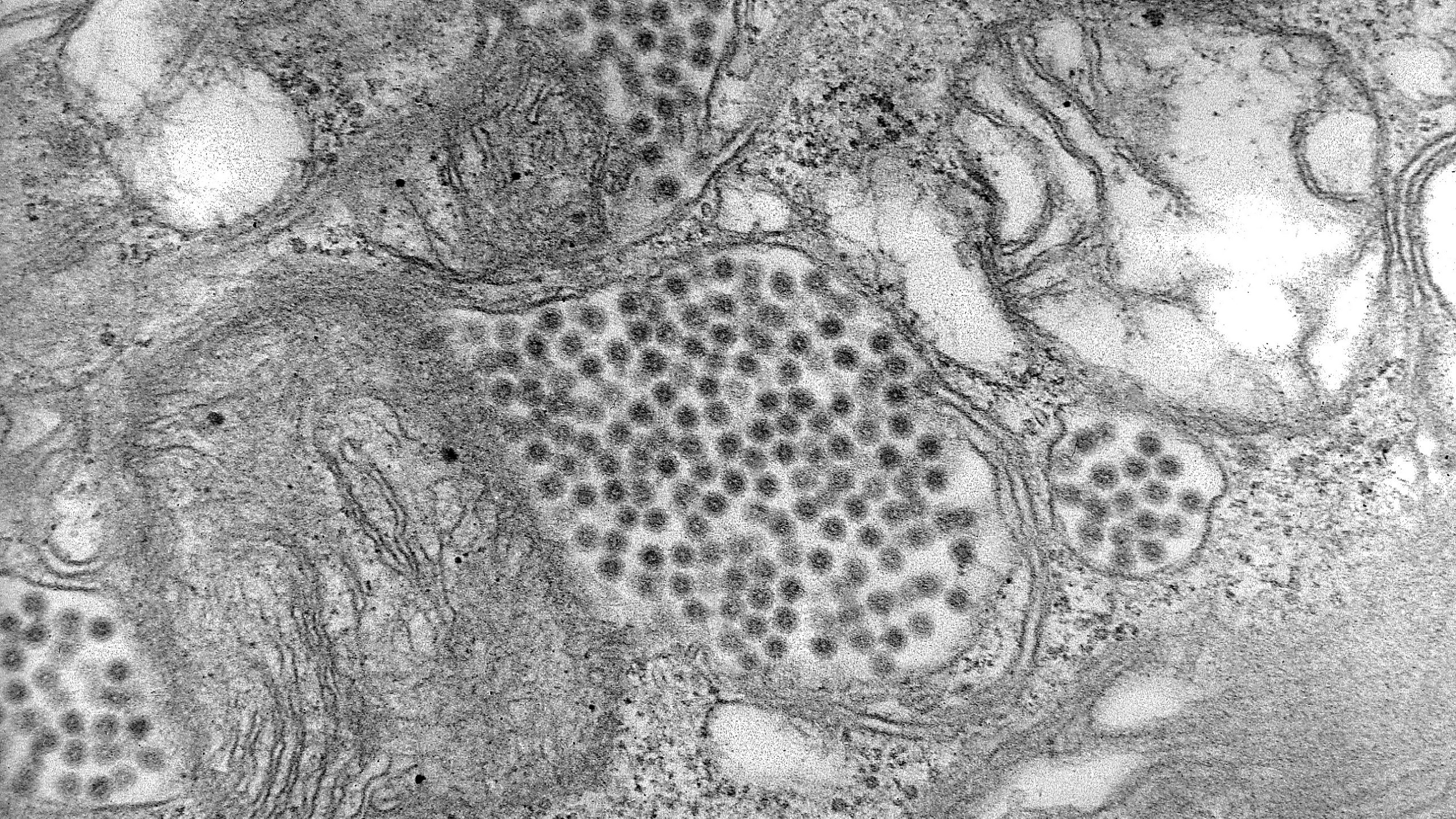 Eastern Equine Encephalitis virus particles.