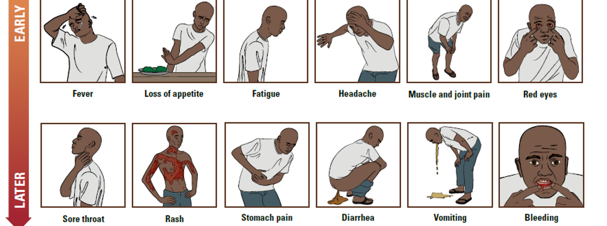 Pictures of symptoms experienced by someone with Ebola including fever, anorexia, fatigue, headache, myalgias, then sore threat, rah, vomiting, diarrhea, and possibly bleeding.