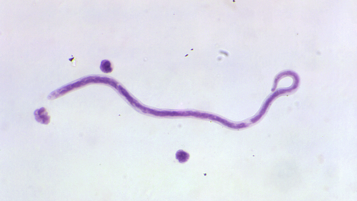 Mansonella pertans about Mansonella perstans microfilaria