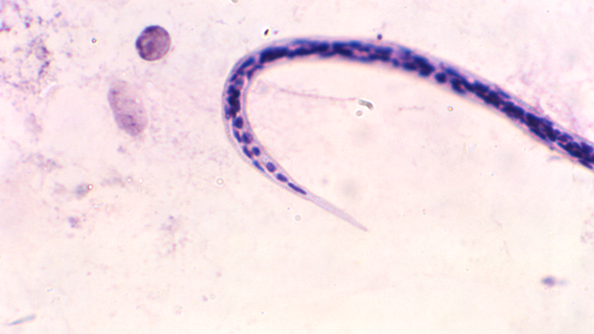 O. volvulus posterior Posterior view of O. volvulvus