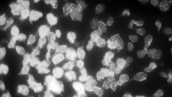 A cluster of Giardia parasites under a microscope